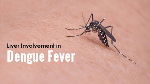 Liver Involvement in Dengue Fever
