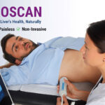 Fibroscan test in ahmedabad