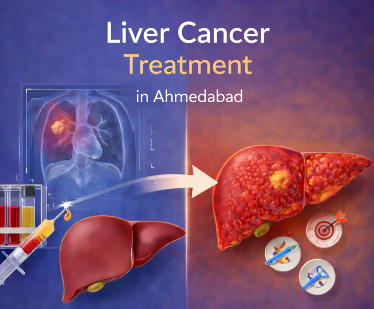 liver-cancer
