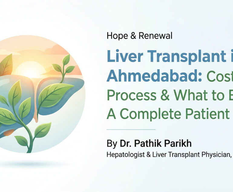 Liver Transplant in Ahmedabad