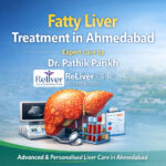 Fatty Liver Treatment in Ahmedabad